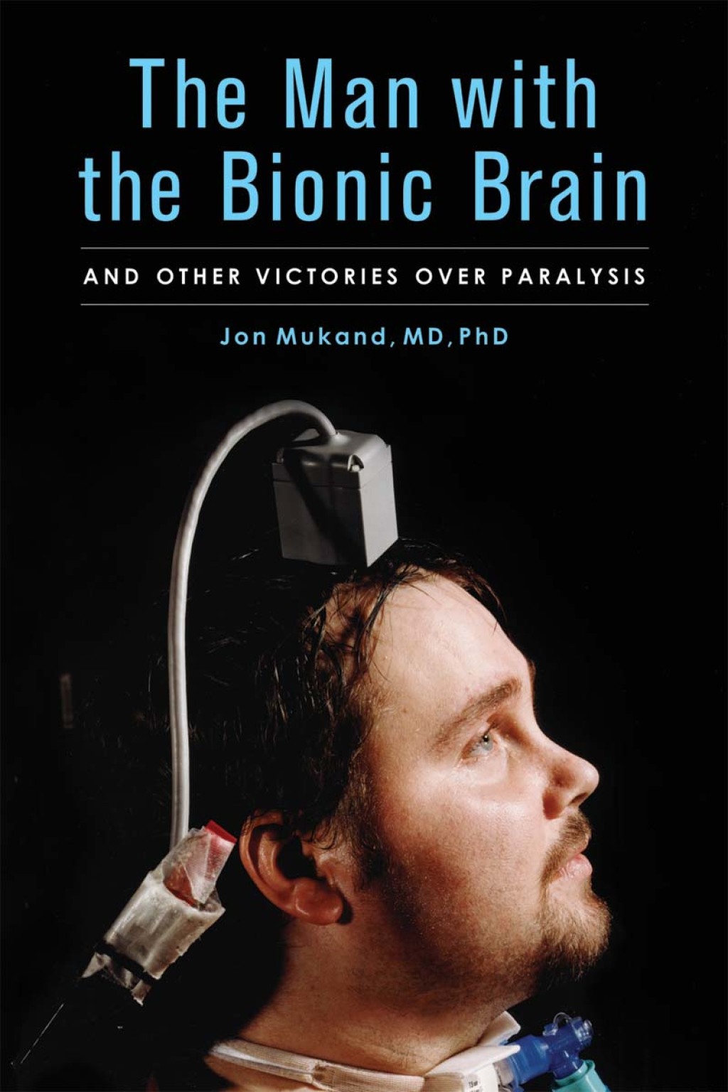 The Man with the Bionic Brain And Other Victories over Paralysis - (PDF/EPUB Version)