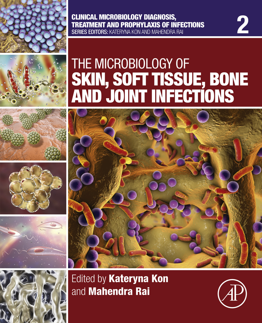 The Microbiology of Skin, Soft Tissue, Bone and Joint Infections â ...