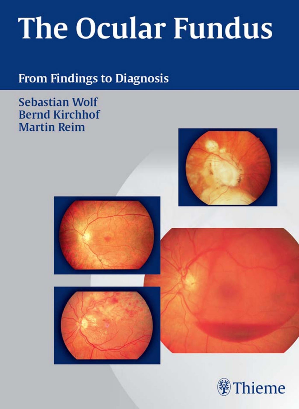 The Ocular Fundus From Findings to Diagnosis 1st Edition â€“ PDF/EPUB Version Downloadable