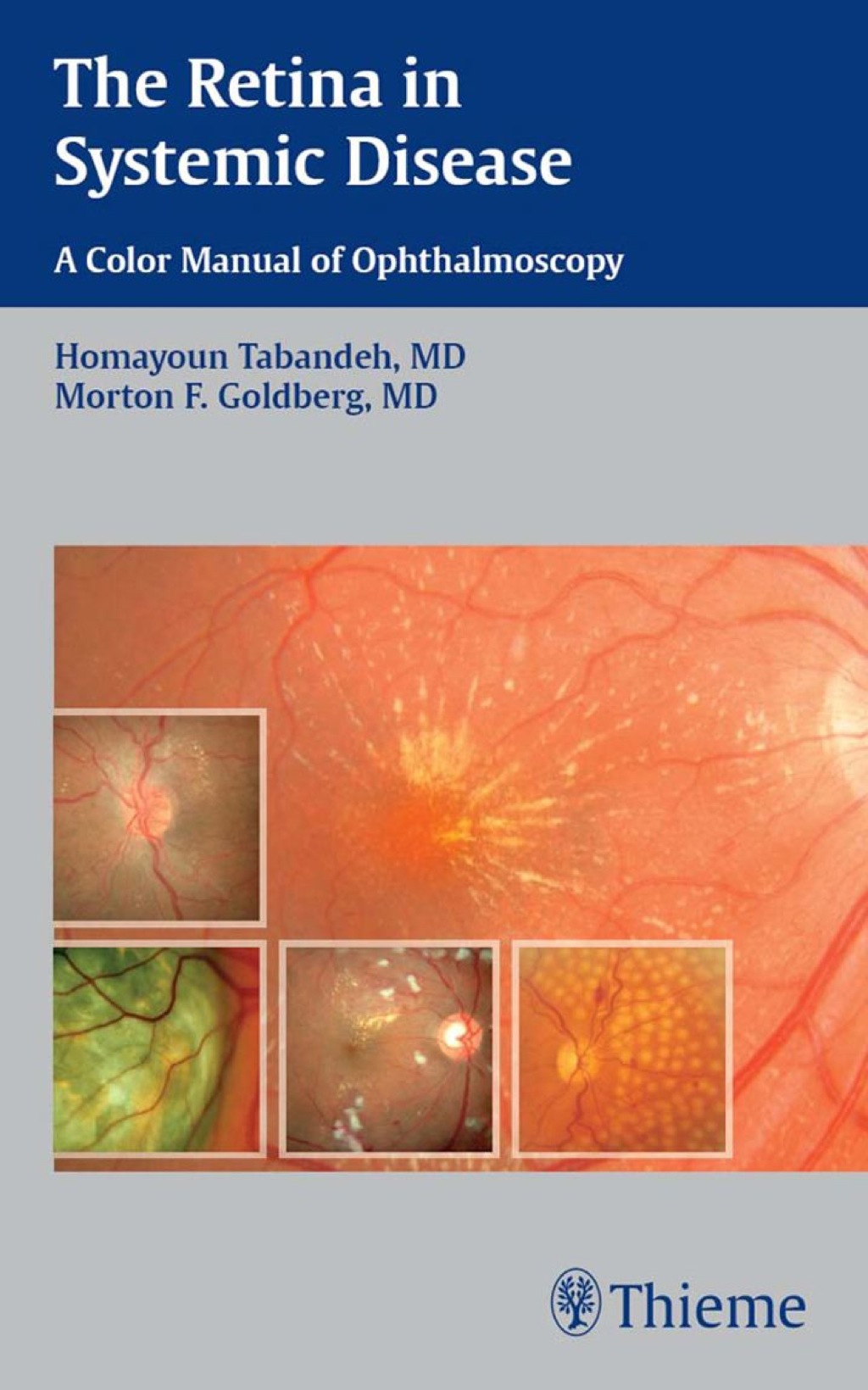 The Retina in Systemic Disease A Color Manual of Ophthalmoscopy 1st ...