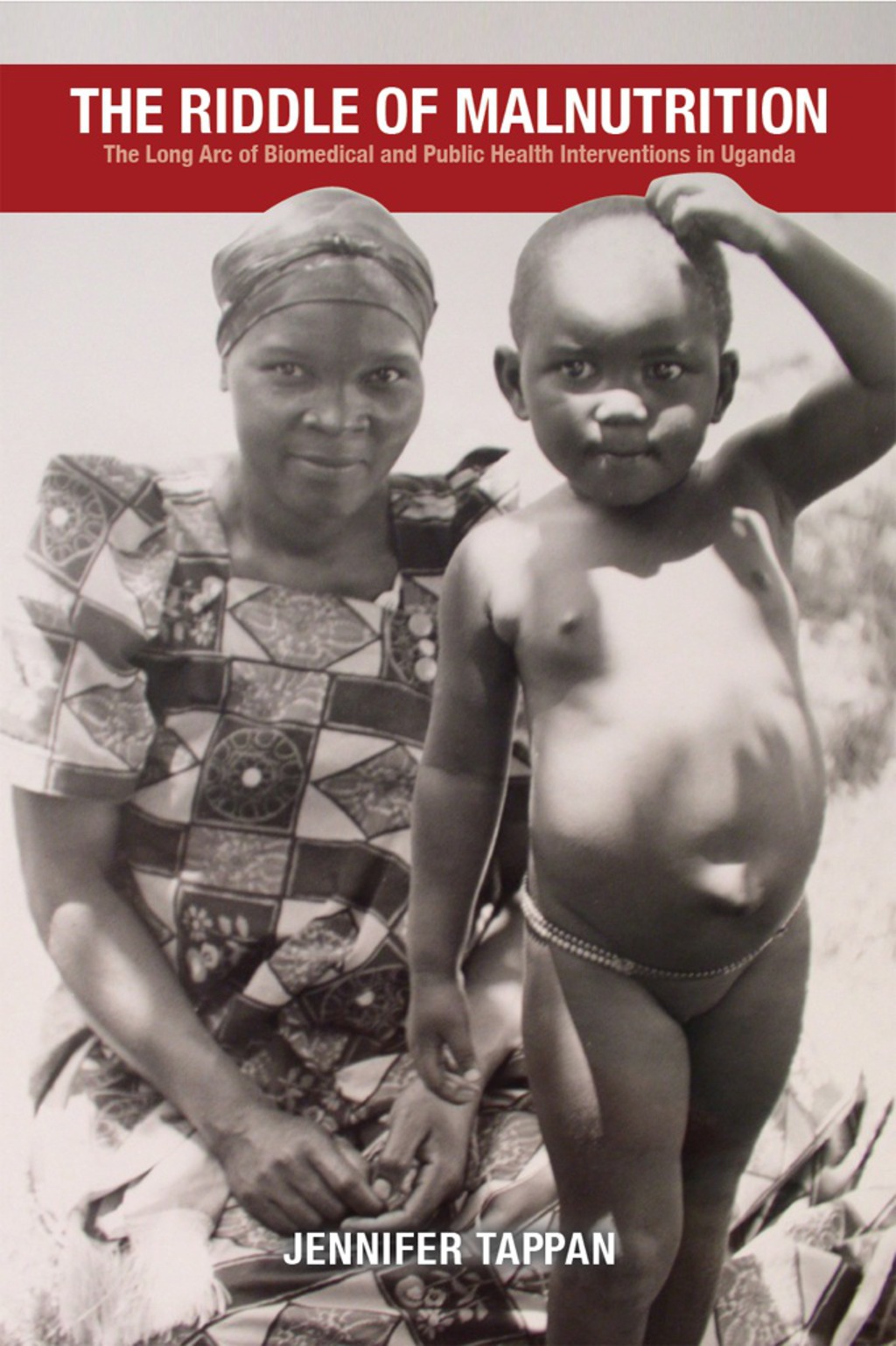 The Riddle of Malnutrition The Long Arc of Biomedical and Public Health Interventions in Uganda 1st Edition - (PDF/EPUB Version)
