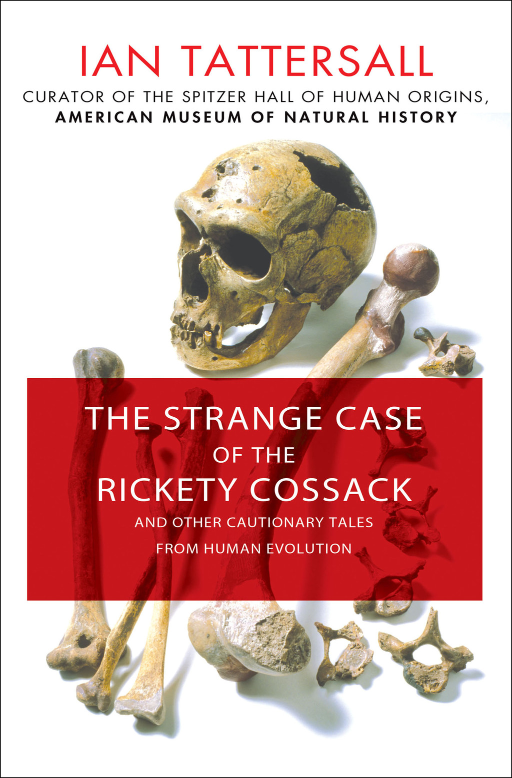 The Strange Case of the Rickety Cossack and Other Cautionary Tales from Human Evolution - (PDF/EPUB Version)