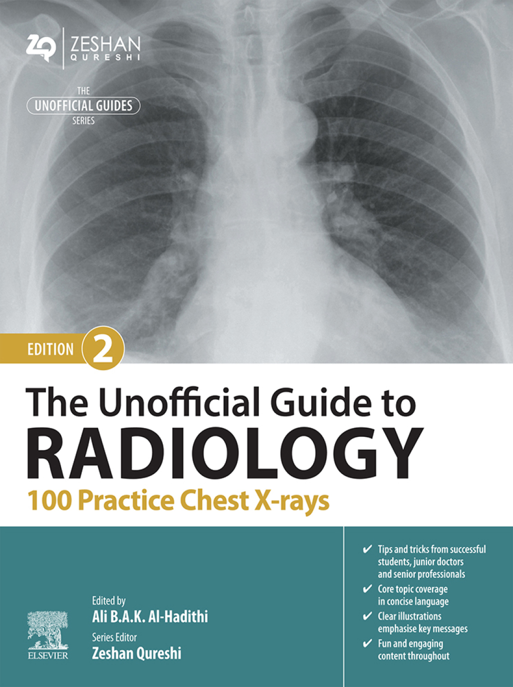 The Unofficial Guide to Radiology: 100 Practice Chest X Rays 2nd Edition - (PDF/EPUB Version)
