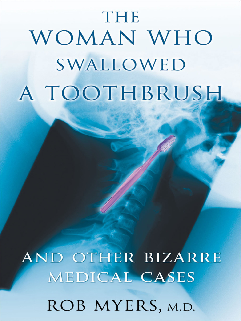 The Woman Who Swallowed a Toothbrush And Other Bizarre Medical Cases - (PDF/EPUB Version)