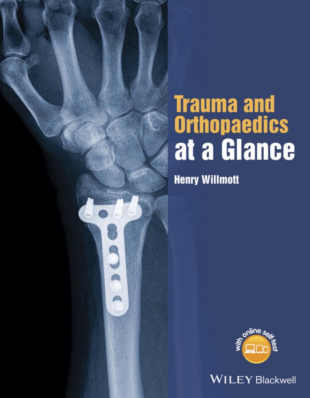 Trauma and Orthopaedics at a Glance 1st Edition - (PDF/EPUB Version)