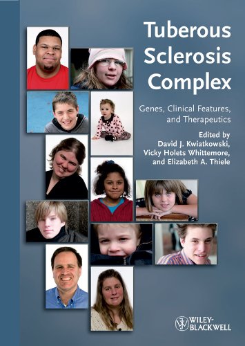 Tuberous Sclerosis Complex: Genes, Clinical Features and Therapeutics ...