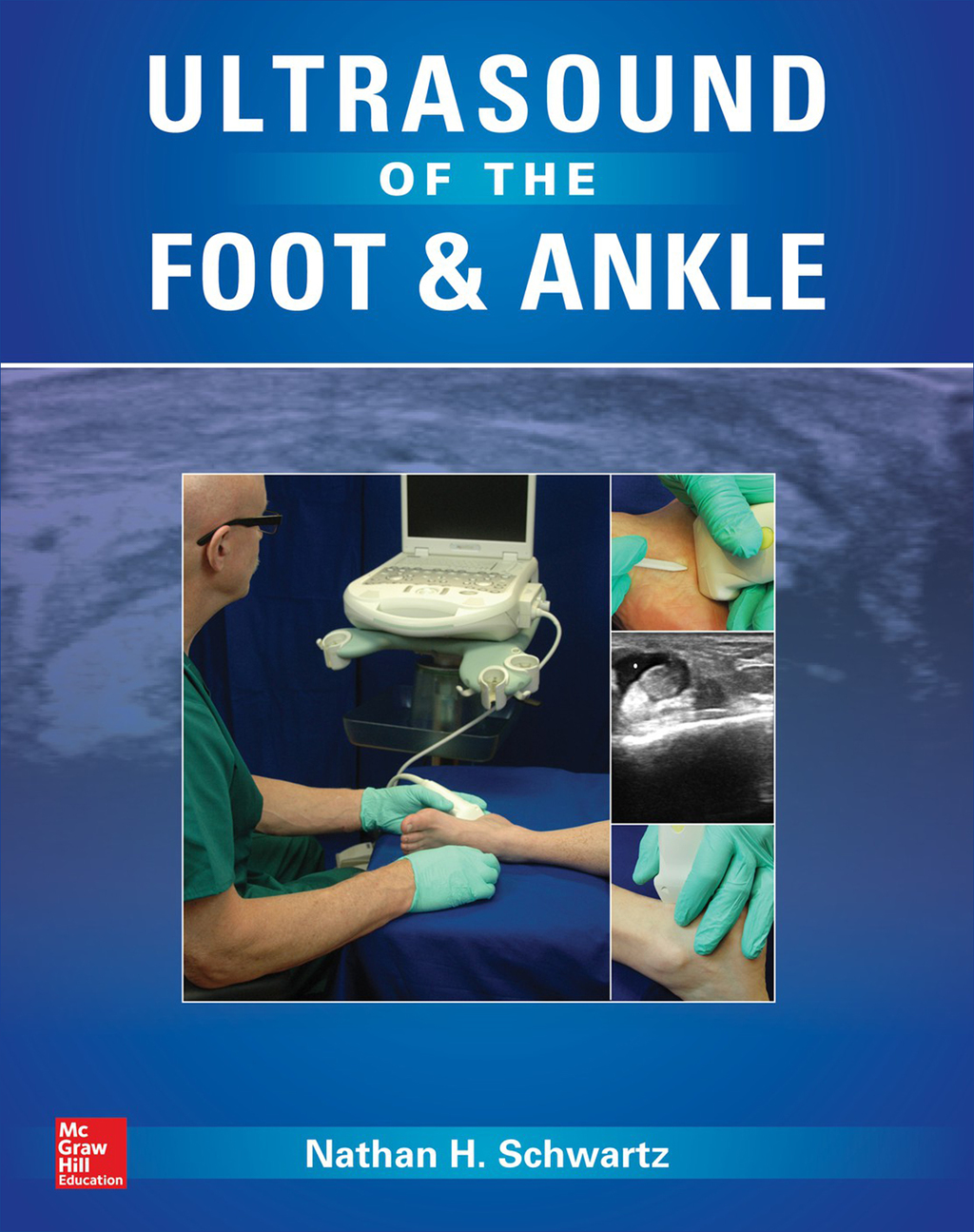 Ultrasound of the Foot and Ankle Diagnostic and Interventional ...