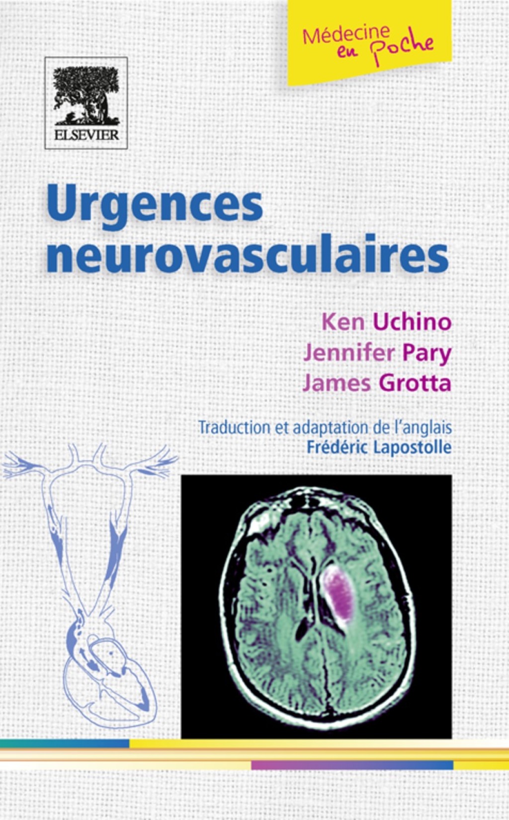 Urgences neurovasculaires - (PDF/EPUB Version)
