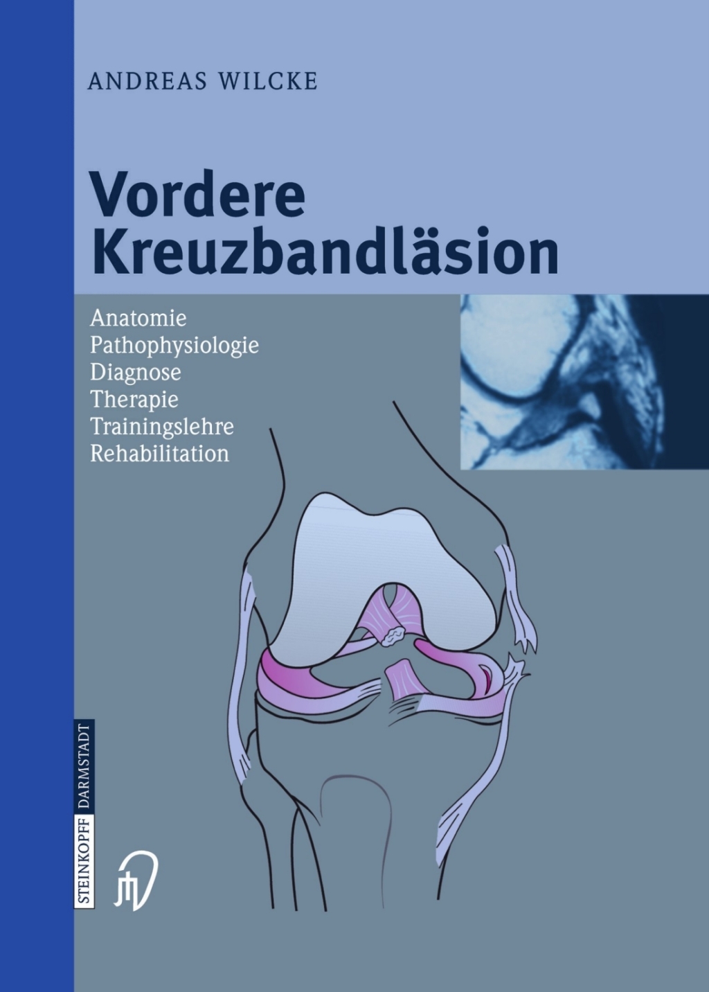 Vordere KreuzbandlÃ¤sion Anatomie Pathophysiologie Diagnose Therapie Trainingslehre Rehabilitation  â€“ PDF/EPUB Version Downloadable