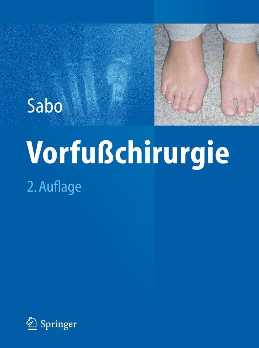 VorfuÃŸchirurgie 2nd Edition â€“ PDF/EPUB Version Downloadable