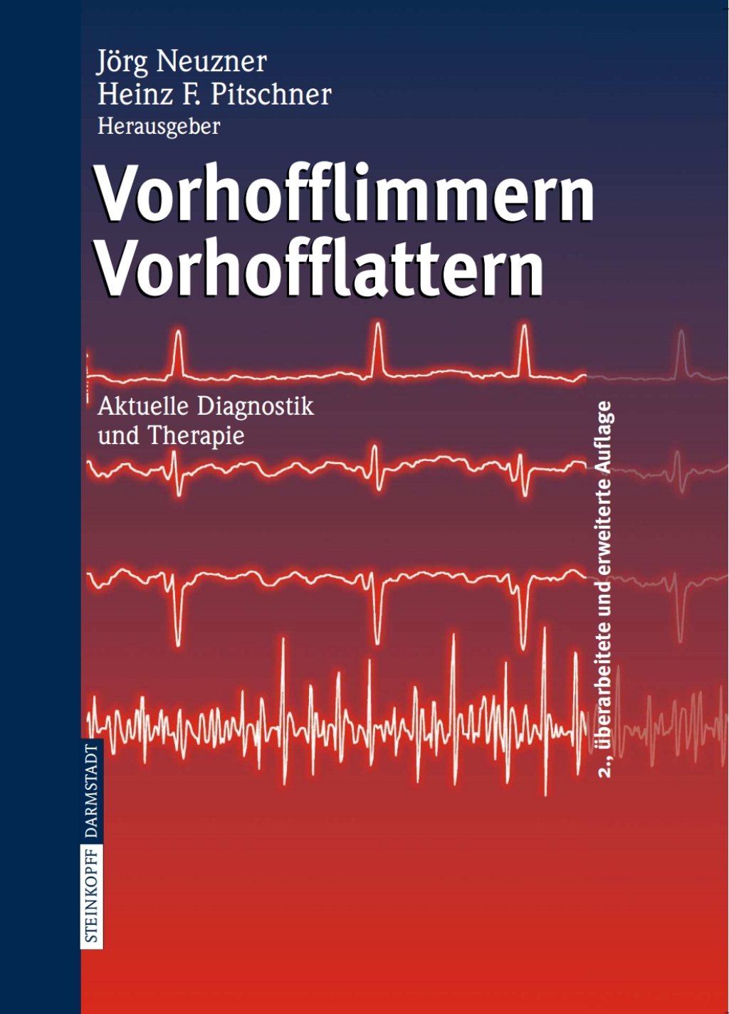 Vorhofflimmern Vorhofflattern Aktuelle Diagnostik und Therapie 2nd Edition â€“ PDF/EPUB Version Downloadable