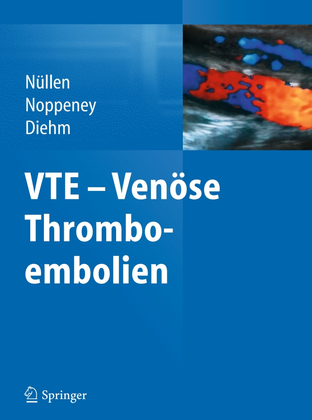 VTE - VenÃ¶se Thromboembolien  â€“ PDF/EPUB Version Downloadable