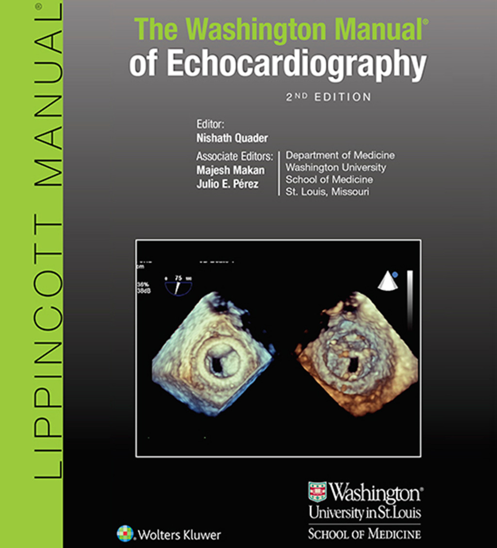 Washington University Manual of Echocardiography 2nd Edition â€“ PDF/EPUB Version Downloadable