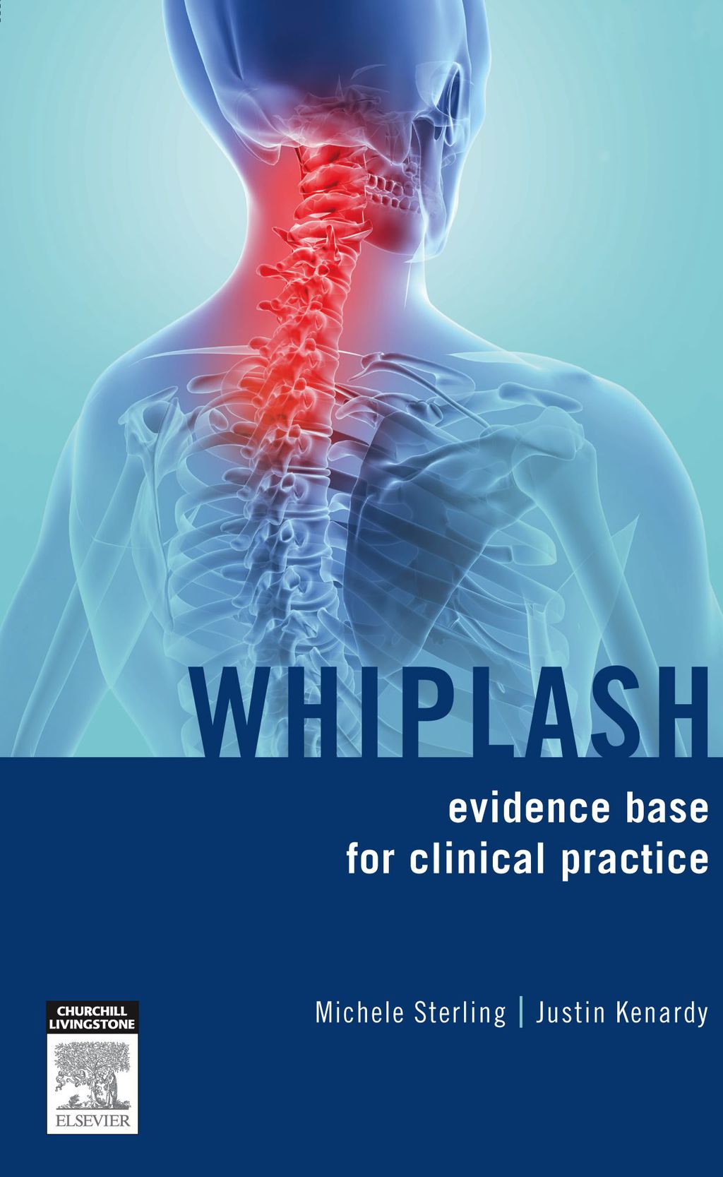 Whiplash 1st Edition â€“ PDF/EPUB Version Downloadable