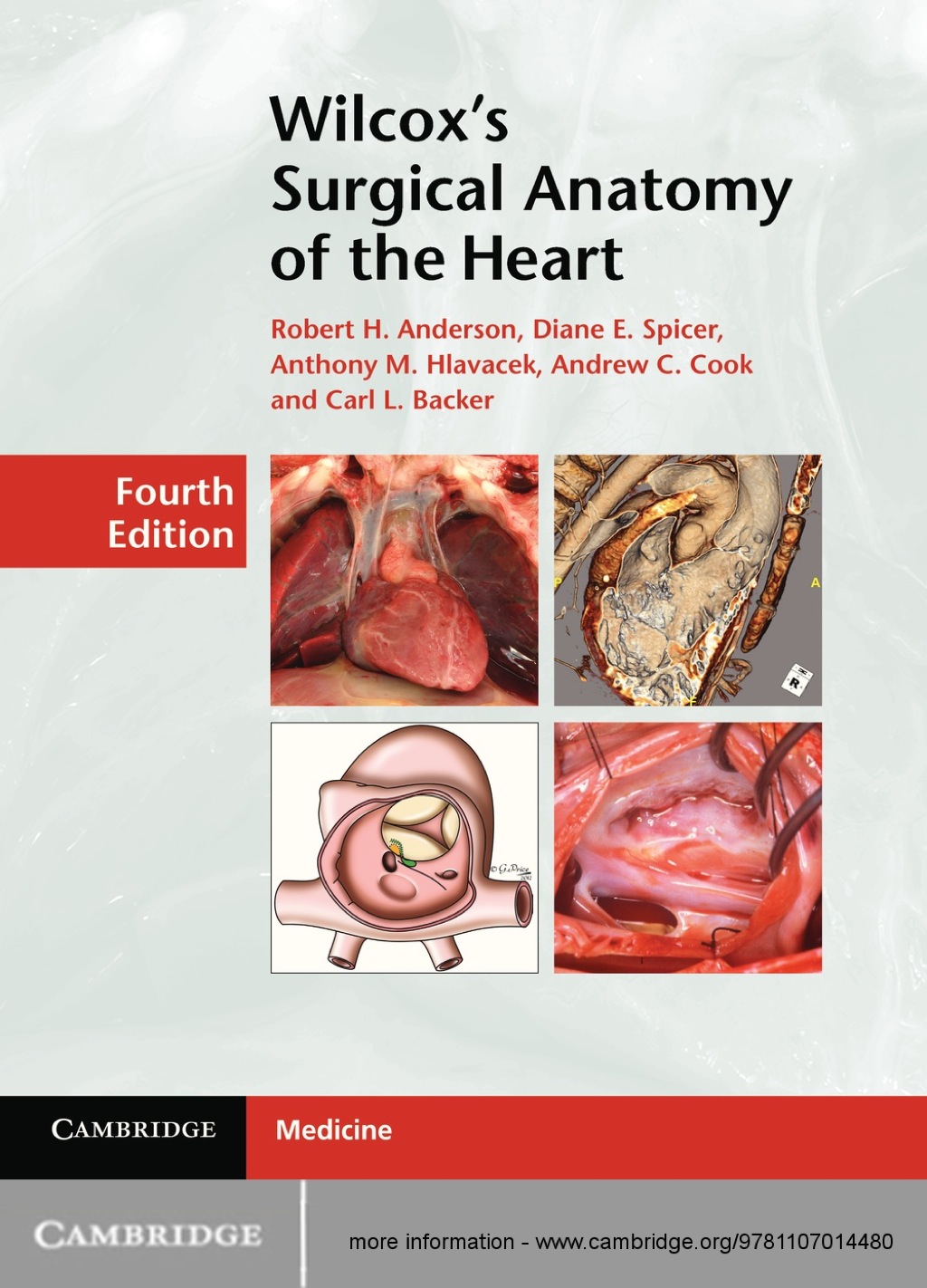 Wilcox's Surgical Anatomy of the Heart 4th Edition â€“ PDF/EPUB Version Downloadable
