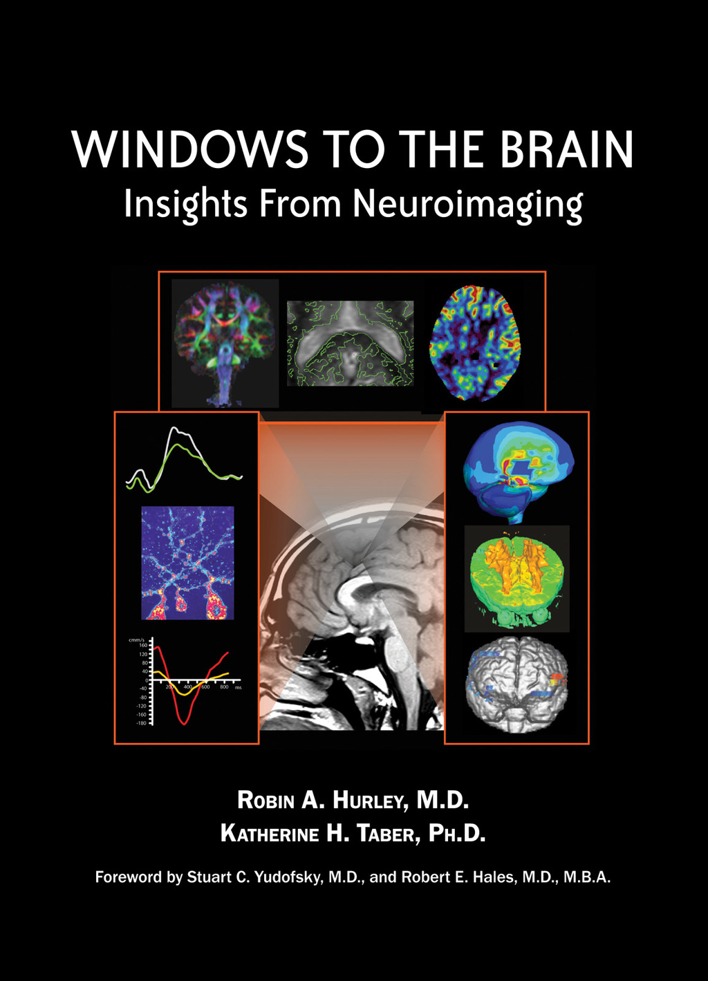 Windows to the Brain Insights From Neuroimaging  â€“ PDF/EPUB Version Downloadable