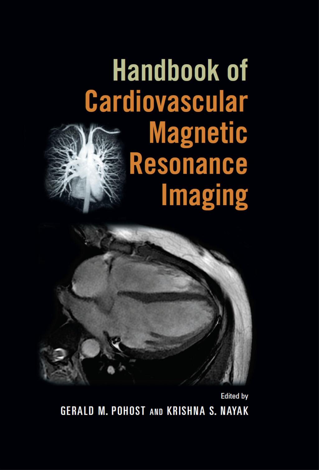 Women and Heart Disease 2nd Edition â€“ PDF/EPUB Version Downloadable