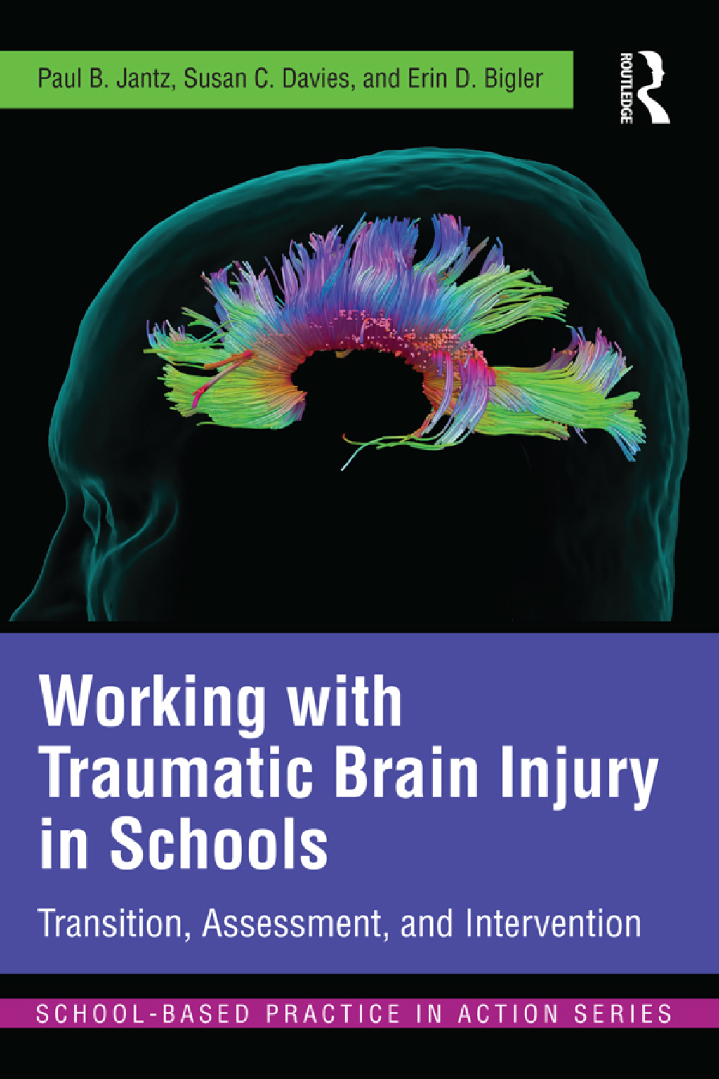 Working with Traumatic Brain Injury in Schools Transition, Assessment, and Intervention 1st Edition â€“ PDF/EPUB Version Downloadable