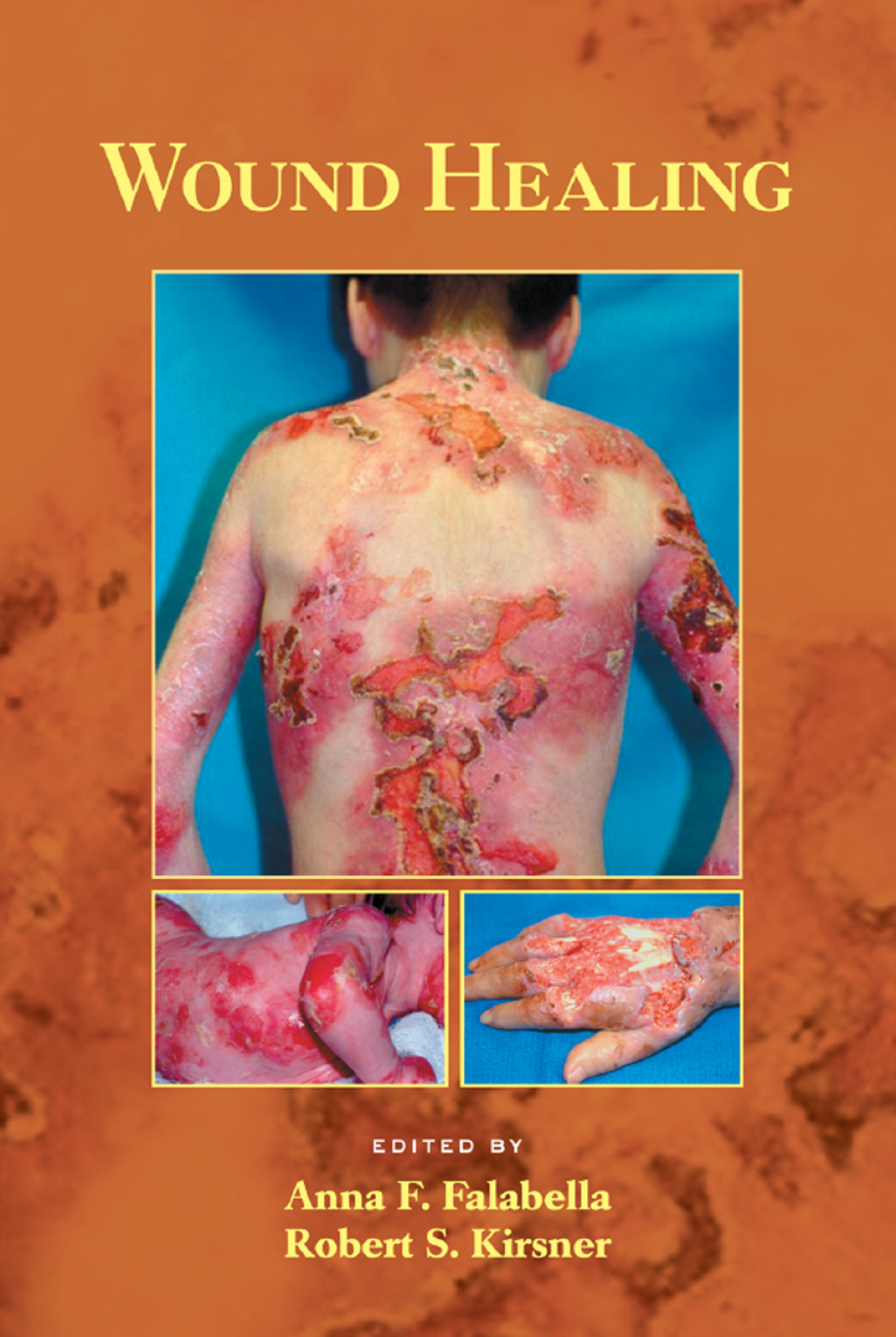 Wound Healing 1st Edition â€“ PDF/EPUB Version Downloadable