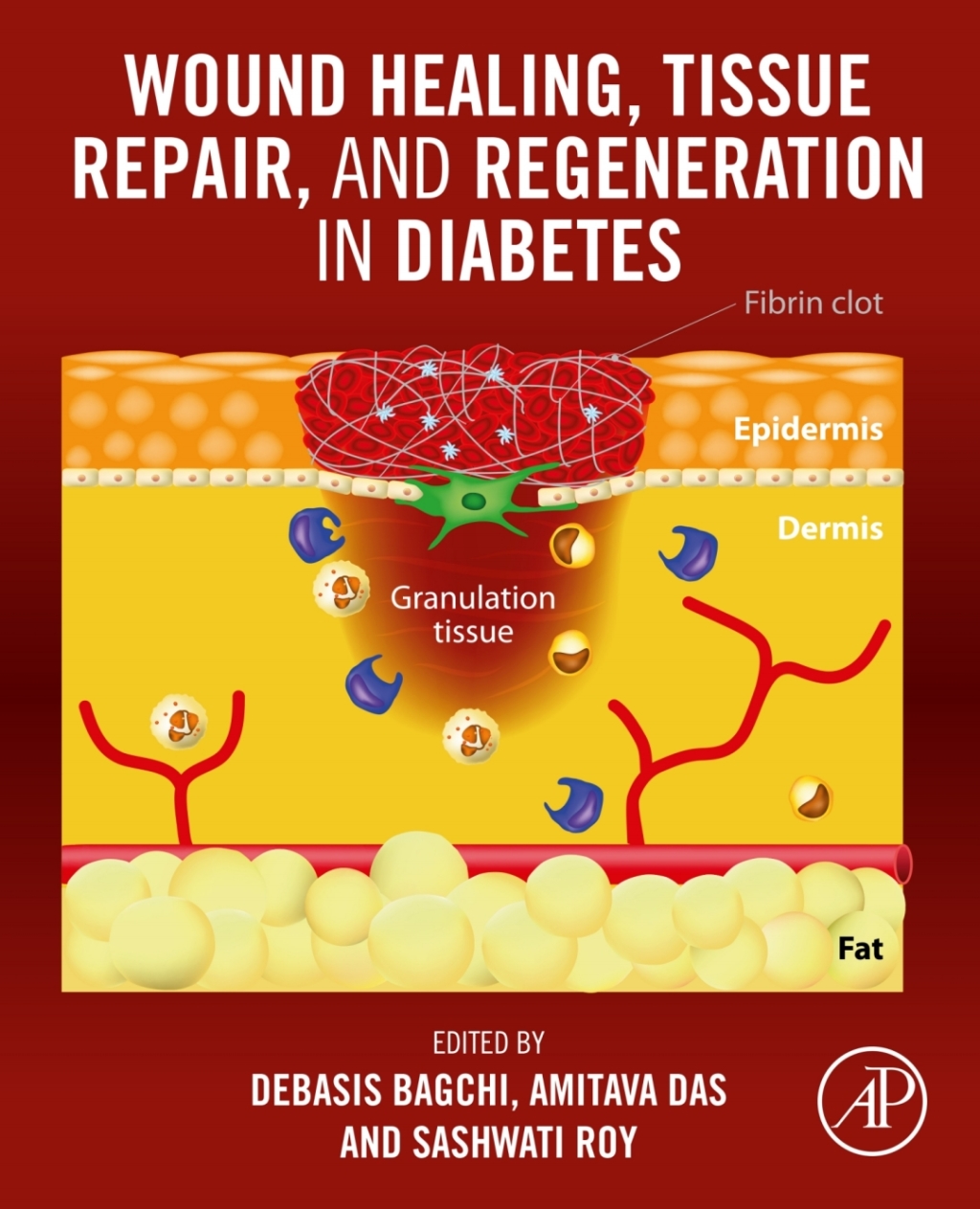 Wound Healing, Tissue Repair, and Regeneration in Diabetes 1st Edition â€“ PDF/EPUB Version Downloadable