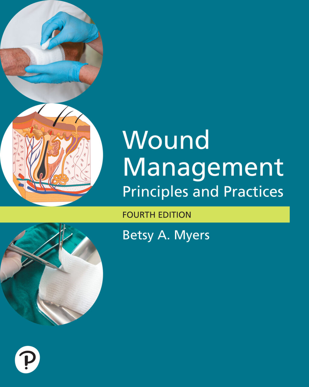 Wound Management: Principles and Practice 4th Edition â€“ PDF/EPUB Version Downloadable