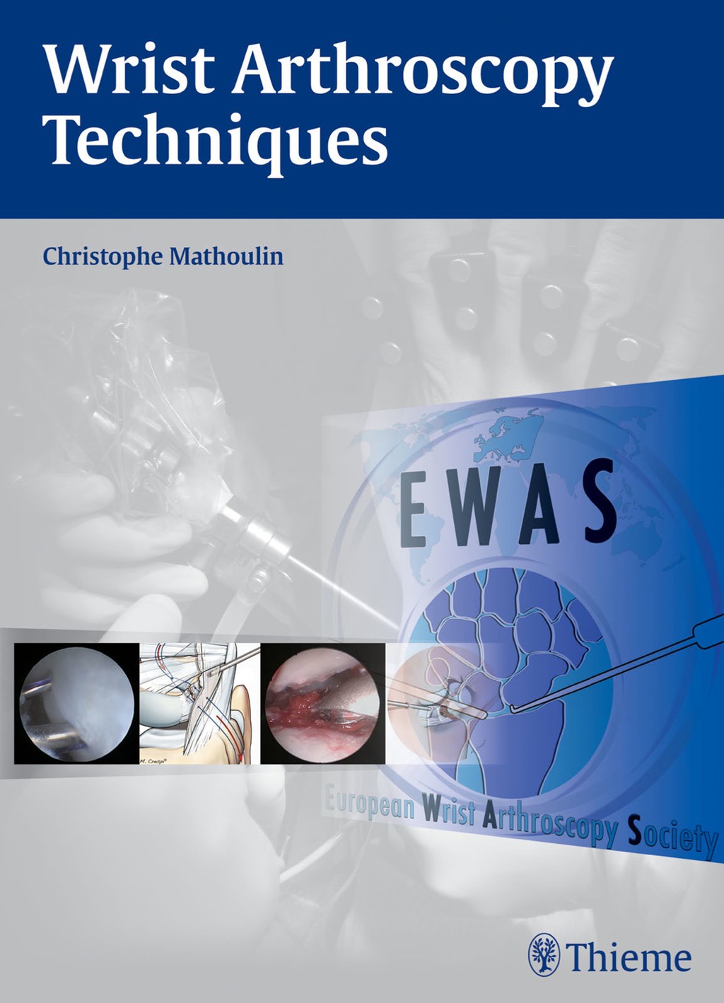 Wrist Arthroscopy Techniques 1st Edition â€“ PDF/EPUB Version Downloadable