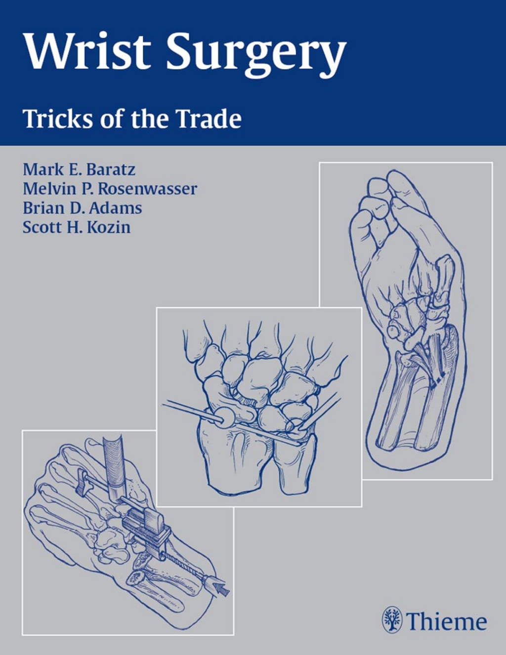 Wrist Surgery Tricks of the Trade 1st Edition â€“ PDF/EPUB Version Downloadable