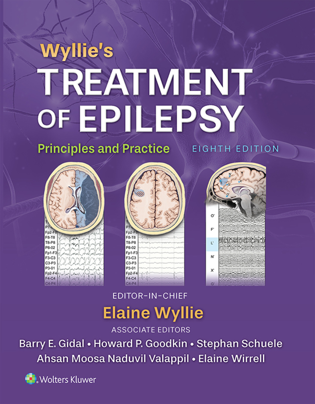 Wyllie's Treatment of Epilepsy eBook with Multimedia 8th Edition â€“ PDF/EPUB Version Downloadable