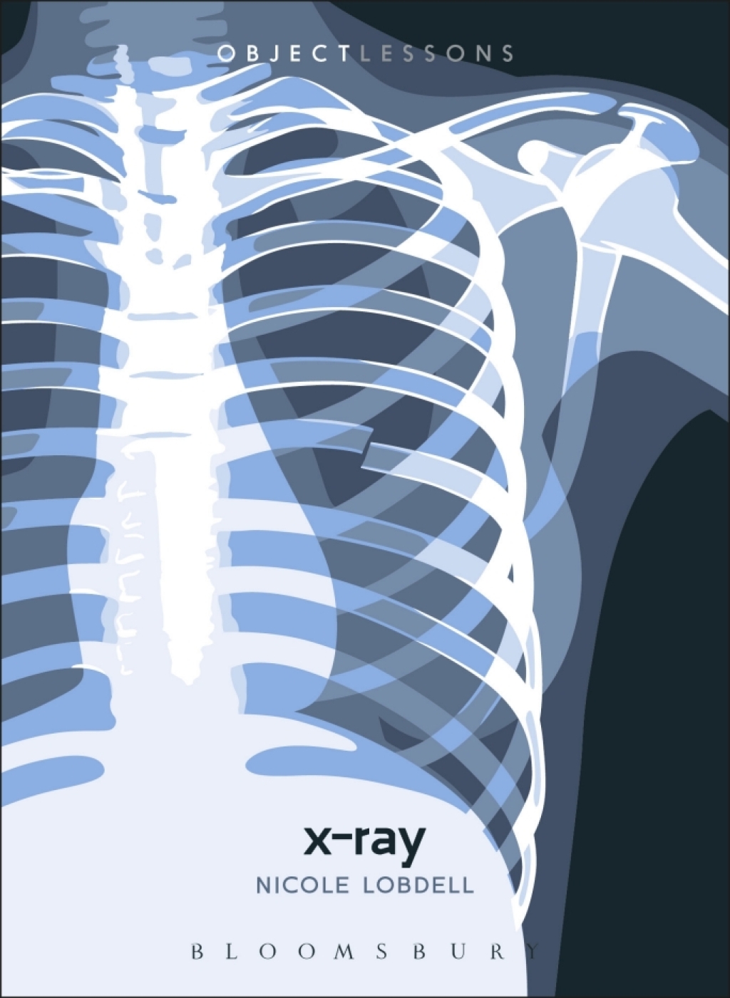 X-ray 1st Edition - (PDF/EPUB Version)