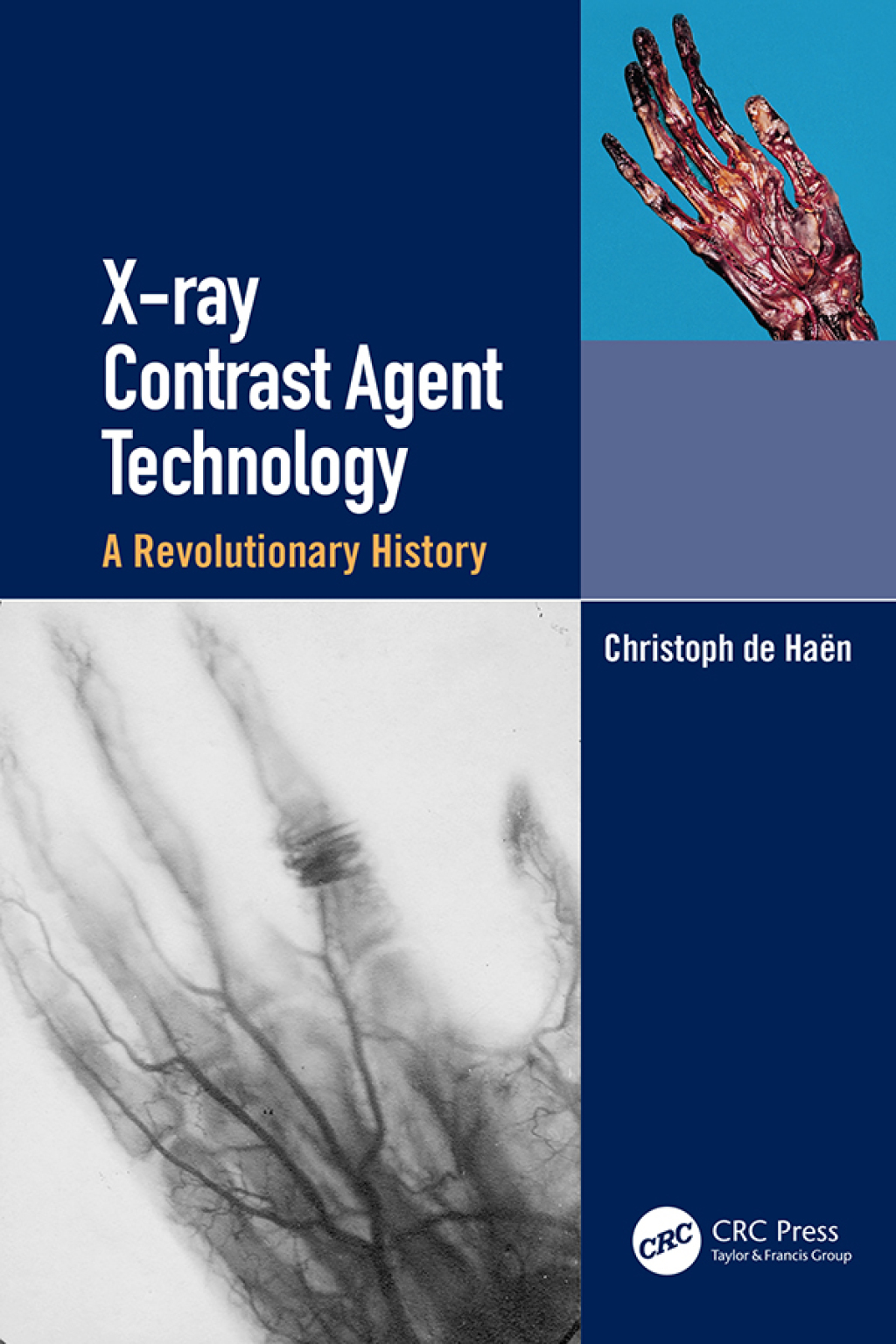 X-ray Contrast Agent Technology A Revolutionary History 1st Edition â€“ PDF/EPUB Version Downloadable