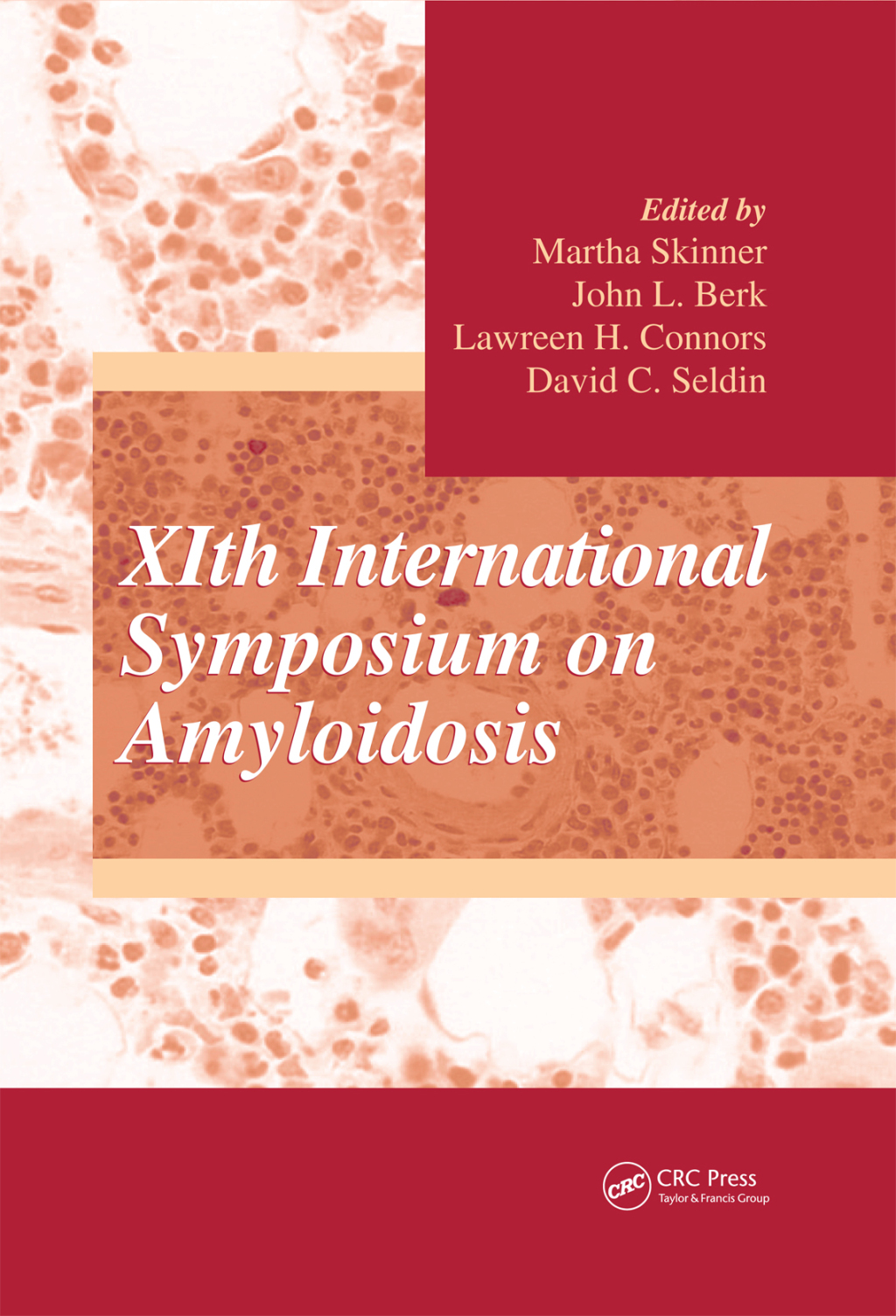 XIth International Symposium on Amyloidosis 1st Edition â€“ PDF/EPUB Version Downloadable