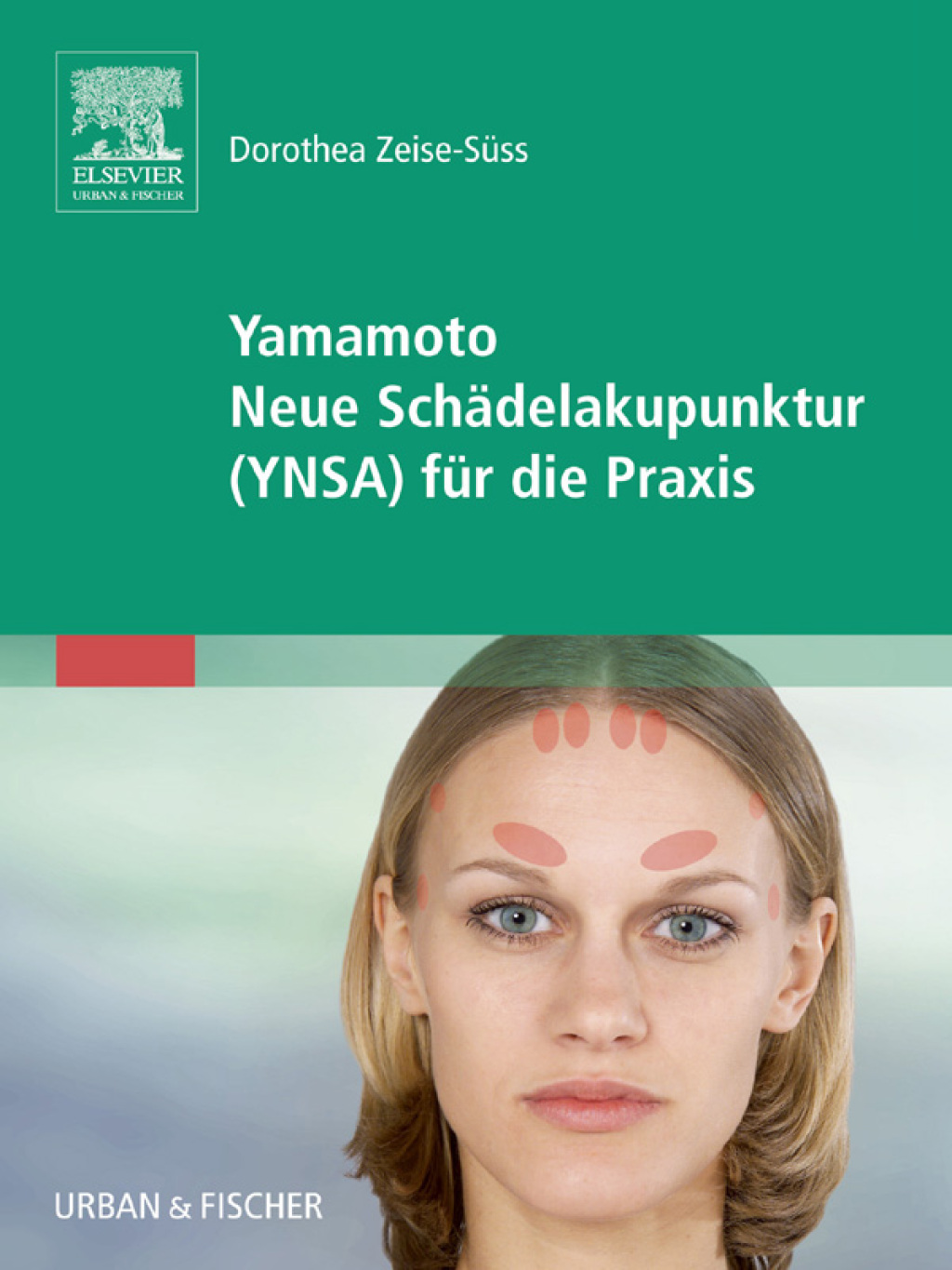 Yamamoto Neue SchÃ¤delakupunktur (YNSA) fÃ¼r die Praxis mit Zugang zum Elsevier-Portal  â€“ PDF/EPUB Version Downloadable