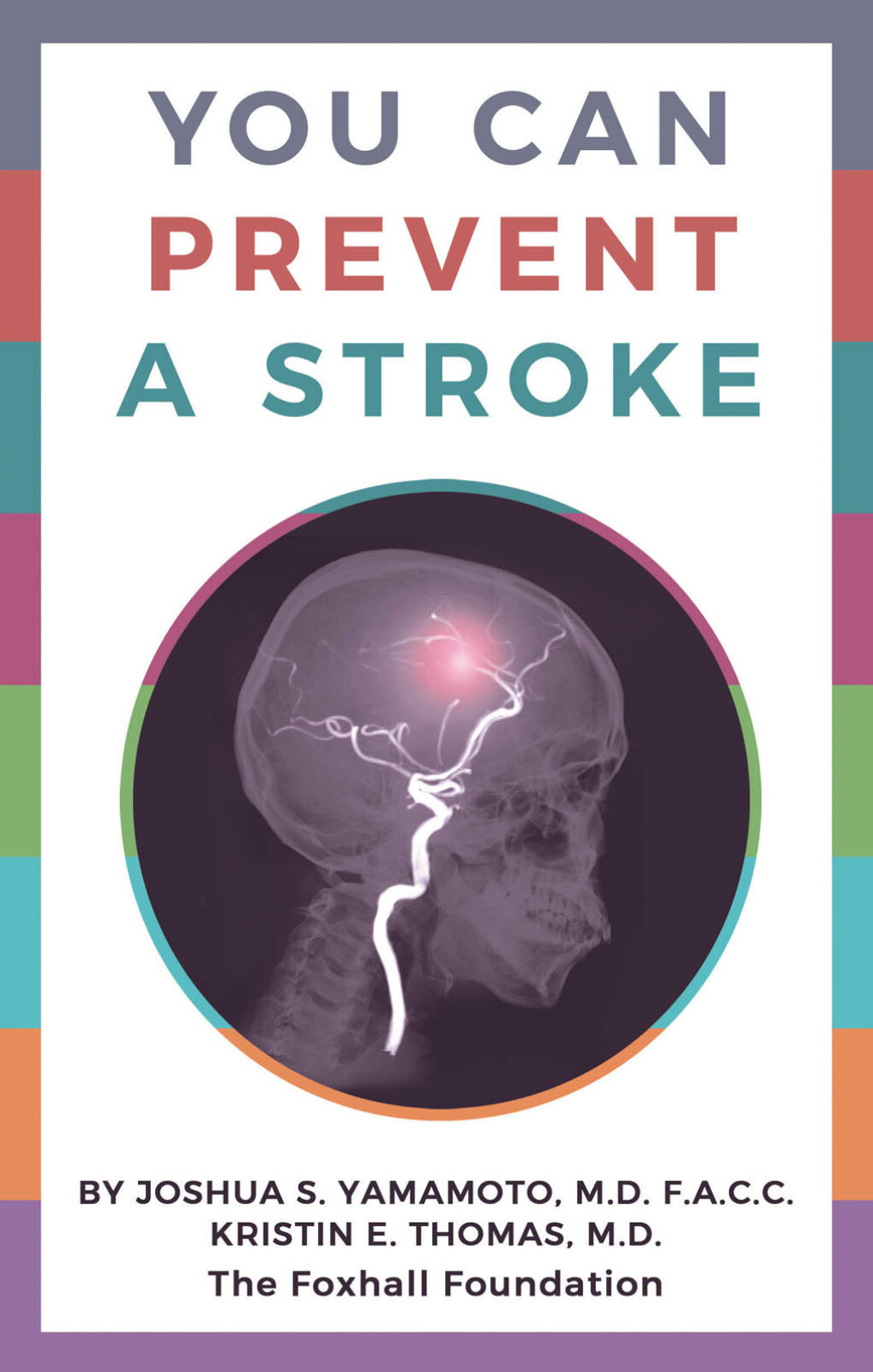 You Can Prevent a Stroke - (PDF/EPUB Version)