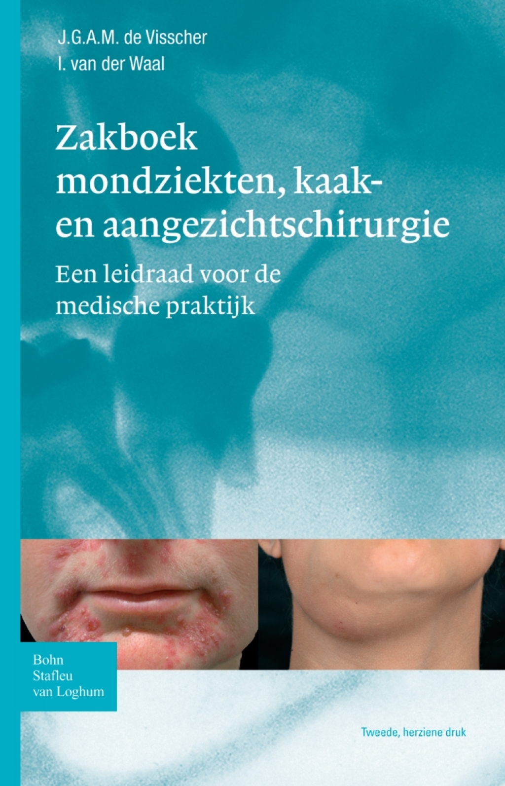 Zakboek mondziekten, kaak- en aangezichtschirurgie Een leidraad voor de medische praktijk 2nd Edition â€“ PDF/EPUB Version Downloadable