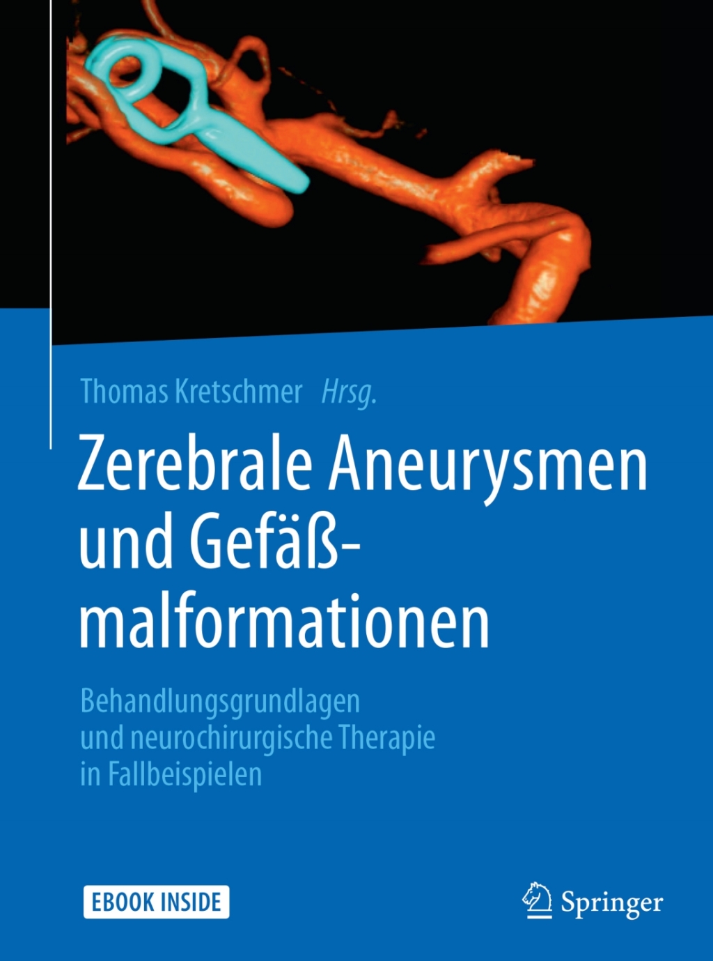 Zerebrale Aneurysmen und GefÃ¤ÃŸmalformationen Behandlungsgrundlagen und neurochirurgische Therapie in Fallbeispielen  â€“ PDF/EPUB Version Downloadable