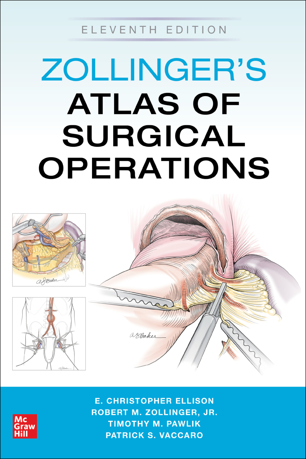 Zollinger's Atlas of Surgical Operations 11th Edition â€“ PDF/EPUB Version Downloadable