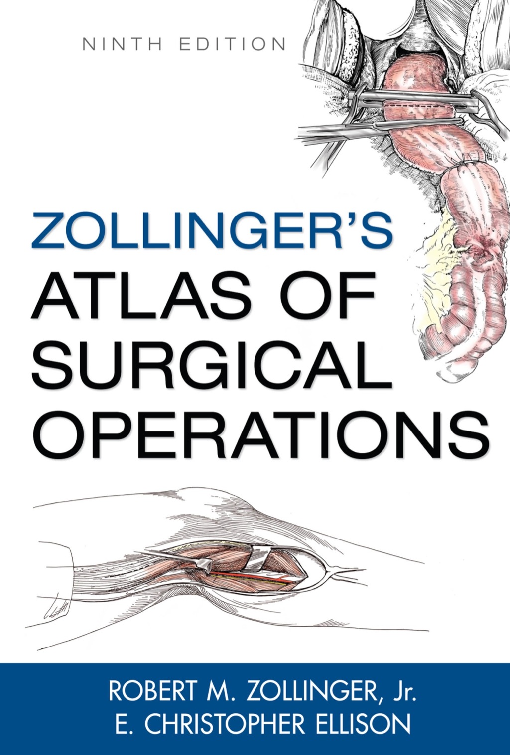Zollinger's Atlas of Surgical Operations 9th Edition â€“ PDF/EPUB Version Downloadable